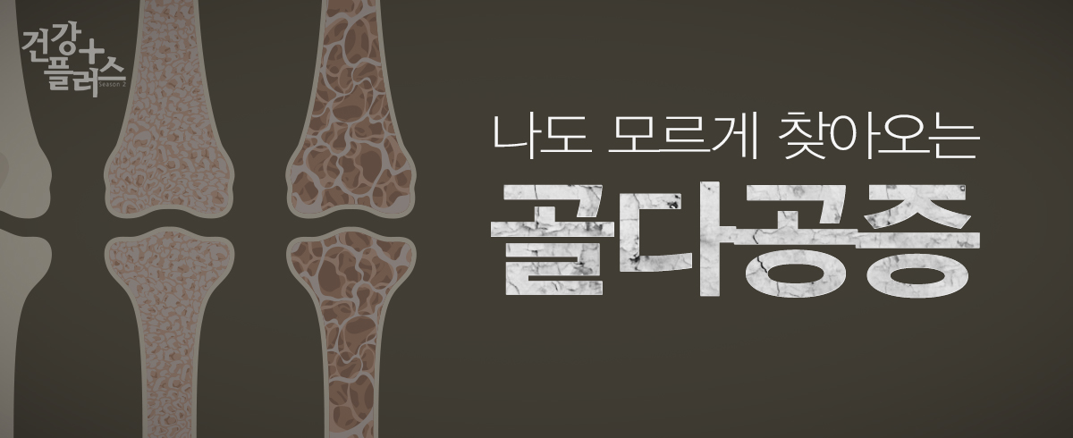 골다공증